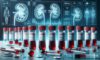 Kidney Blood Test: Your Essential Guide for Blackburn Residents