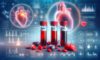 Cholesterol Blood Test: Essential Health Guide for Milton Keynes