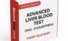 Blood Alcohol Level Testing: An Essential Guide for You